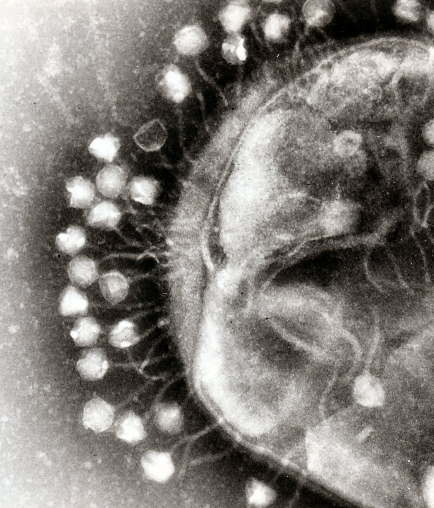 An electron micrograph of bacteriophages attached to a bacterial cell. These viruses are the size and shape of coliphage T1. Image: Wikipedia
